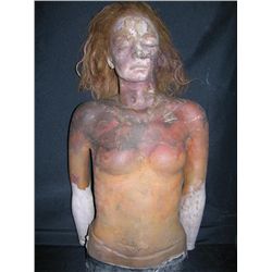 Gabrielle Anwar Upper Body Prosthetic