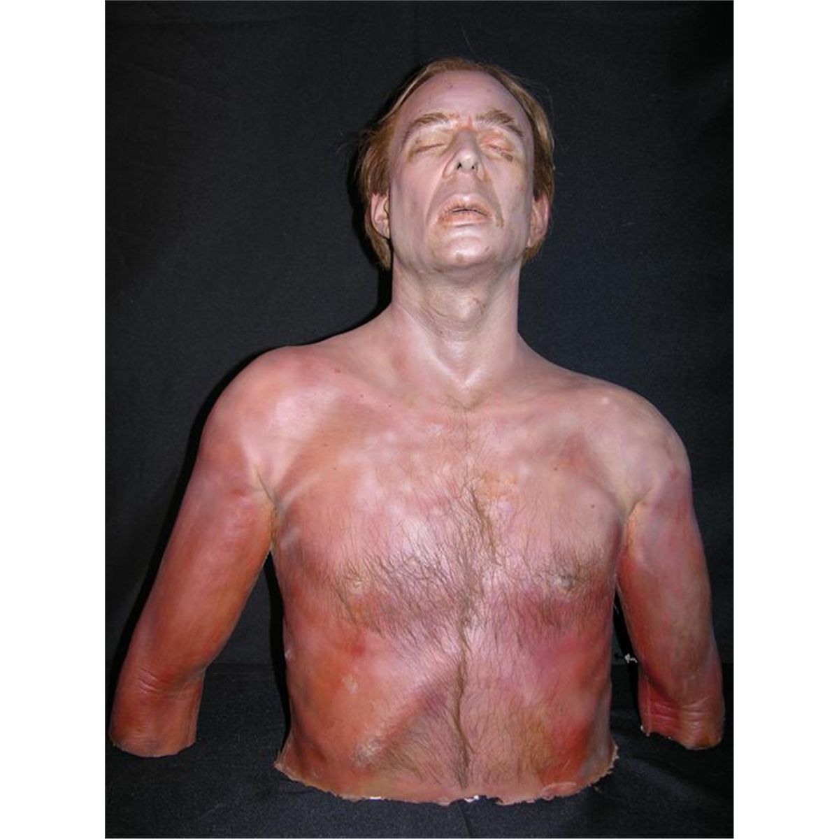 Terry Kinney Upper Body Prosthetic