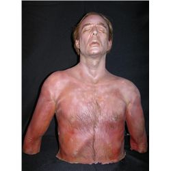 Terry Kinney Upper Body Prosthetic