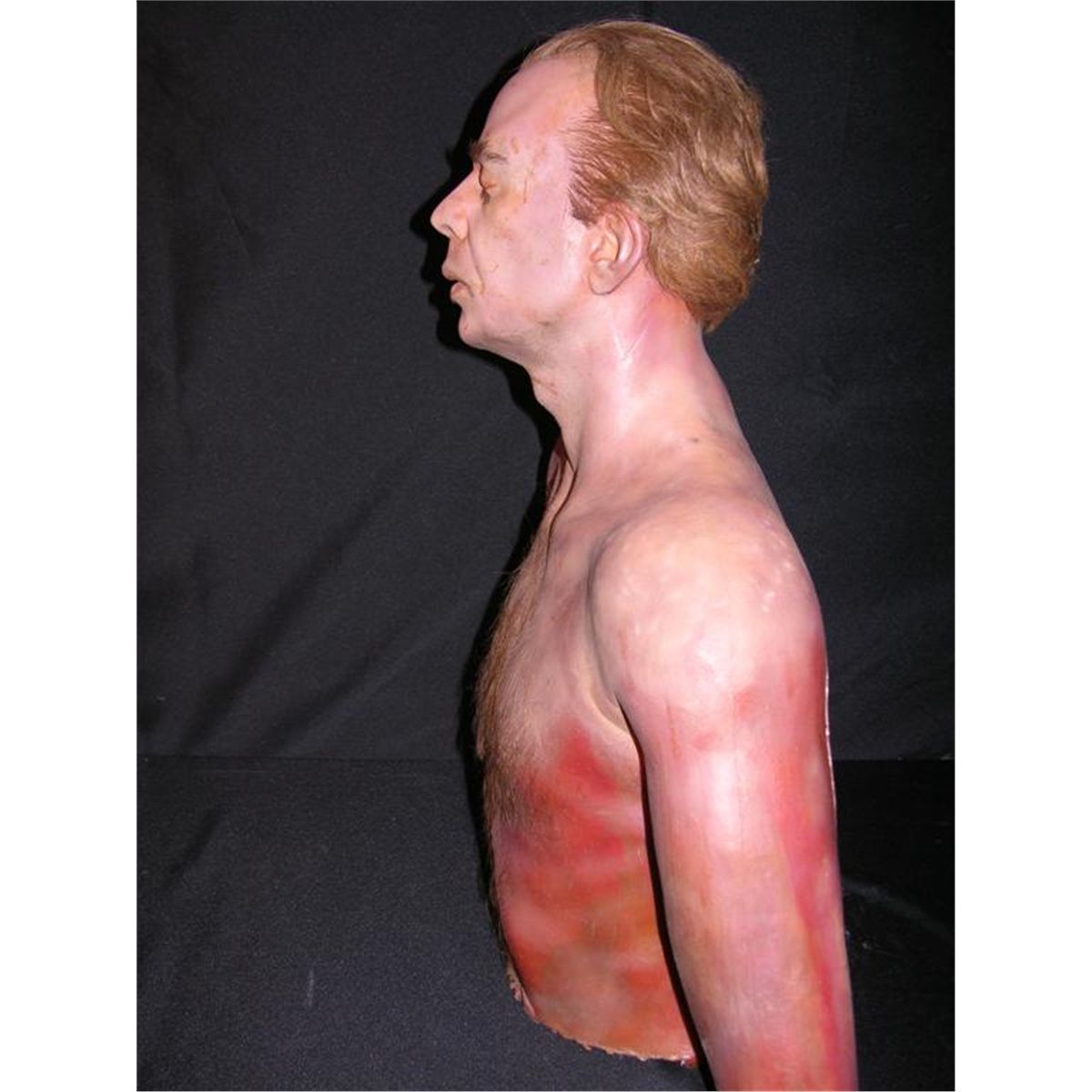 Terry Kinney Upper Body Prosthetic Terry Kinney Upper Body Prosthetic