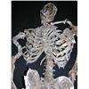 Image 3 : Invasion Skeleton