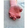 Image 2 : SEVERED ROTTEN ZOMBIE ARM SILICONE GORE CHEWED CHOPPED OFF FINGERS HORROR PROP