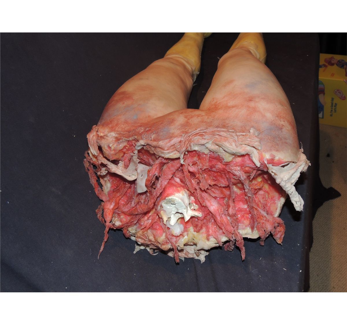 TORN IN HALF FEMALE LOWER BODY WITH LEGS & EXCELLENT GORE ...