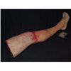 Image 1 : GASHED OPEN AND SEVERED FULL LEG WITH FOOT