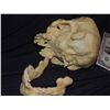 Image 4 : INBRED MUTANT FREAK SKULL WITH LOWER JAW ONE OF A KIND FROM UNKNOWN PRODUCTION