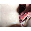 Image 3 : OFF THE MAP FAT MAN SILICONE SURGERY TORSO WITH ENTRAILS NECK AND ARMS SCREEN USED