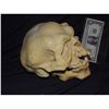 Image 2 : INBRED MUTANT FREAK SKULL WITH LOWER JAW ONE OF A KIND FROM UNKNOWN PRODUCTION