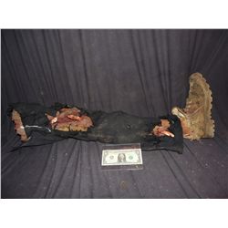 SEVERED LEG WITH COMPOUND FRACTURES AND WARDROBE