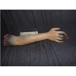 SEVERED ARM WITH GORE AT STUMP AND FINGERS