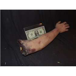 SEVERED ARM WITH EXPOSED BONE AND GORE AT STUMP