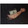 Image 1 : SEVERED ARM WITH EXPOSED BONE AND GORE AT STUMP