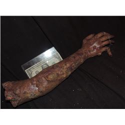 ROTTEN ARM WITH BROKEN FINGER