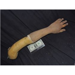 SEVERED ARM WITH CUTS ON FINGERS