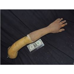 SEVERED ARM WITH CUTS ON FINGERS