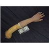 Image 1 : SEVERED ARM WITH CUTS ON FINGERS