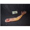 Image 1 : SEVERED TORN OFF ARM WITH GORE AT STUMP 3
