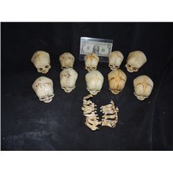 300 HUGE COLLECTION OF DEAD BABY SKULLS WITH JAWS