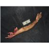 Image 1 : TORN OFF SILICONE ARM WITH EXCELLENT GORE AT SHOULDER