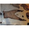 Image 1 : SEVERED LOWER TORSO AND LEGS