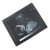Image 2 : Alias (TV) - Sydney's Sonogram X-Rays (Jennifer Garner)