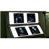 Image 4 : Alias (TV) - Sydney's Sonogram X-Rays (Jennifer Garner)