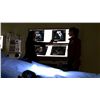 Image 6 : Alias (TV) - Sydney's Sonogram X-Rays (Jennifer Garner)
