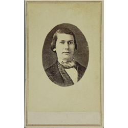 Antique CDV Photograph Unusual Photo Wandering Eye Man
