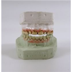 Out of the Furnace Harlan (Woody Harrelson) Hero Teeth Prosthetics