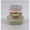 Image 1 : Out of the Furnace Harlan (Woody Harrelson) Hero Teeth Prosthetics