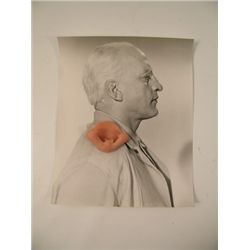 George C. Scott Patton Prosthetic Nose