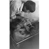 Image 1 : In der Badewanne