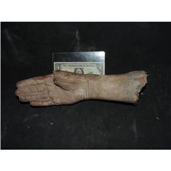 SEVERED HAND WITH CUT OFF THUMB NO RESERVE!