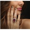 Image 3 : 14KT Yellow Gold 13.07ct Ruby and Diamond Ring