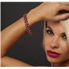 Image 2 : 14KT Yellow Gold 28.98ctw Ruby and Diamond Bracelet