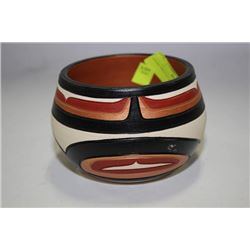 OVOID SPLIT-U DESIGN