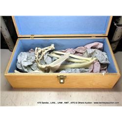 HAND & ARM BONE MODEL (print sequence:) NO#