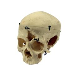 Bones TV Show Adult Skull