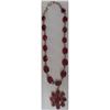 Image 9 : Authentic Ruby Necklace