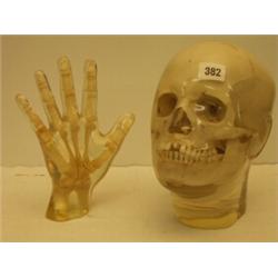 Human skull and hand encased in perspex…