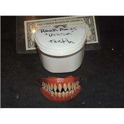 SPIDER-MAN 3 VENOM STUNT TEETH IN CASE