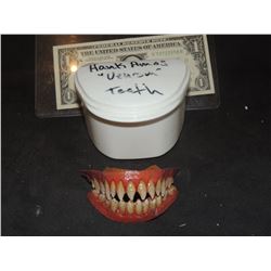 SPIDER-MAN 3 VENOM STUNT TEETH IN CASE