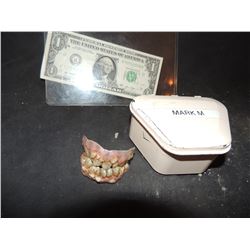 LAST WITCH HUNTER SCREEN USED TEETH 1