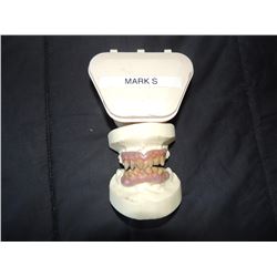 LAST WITCH HUNTER SCREEN USED TEETH 2