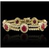 Image 1 : 11.55 ctw Ruby and Diamond Bracelet - 14KT Yellow Gold