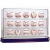 Image 1 : Baseball 15-Ball Glass Deluxe Display Case