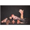 Image 1 : ARMS AND HANDS MISC SEVERED LIMB LOT