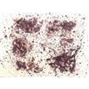 Image 1 : Sam Francis (1923-1994) American, UNTITLED (L.S-3), lithograph, signed in pencil and inscribed...