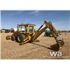 Image 4 : 1980 MASSEY FERGUSON BACKHOE LOADER