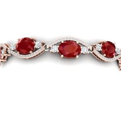 22.15 CTW Royalty Ruby & VS Diamond Bracelet 18K Rose Gold - REF-418W2H - 38962