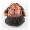 Image 8 : 28 DAYS LATER (2002) - Laboratory Chimp Autopsy Head